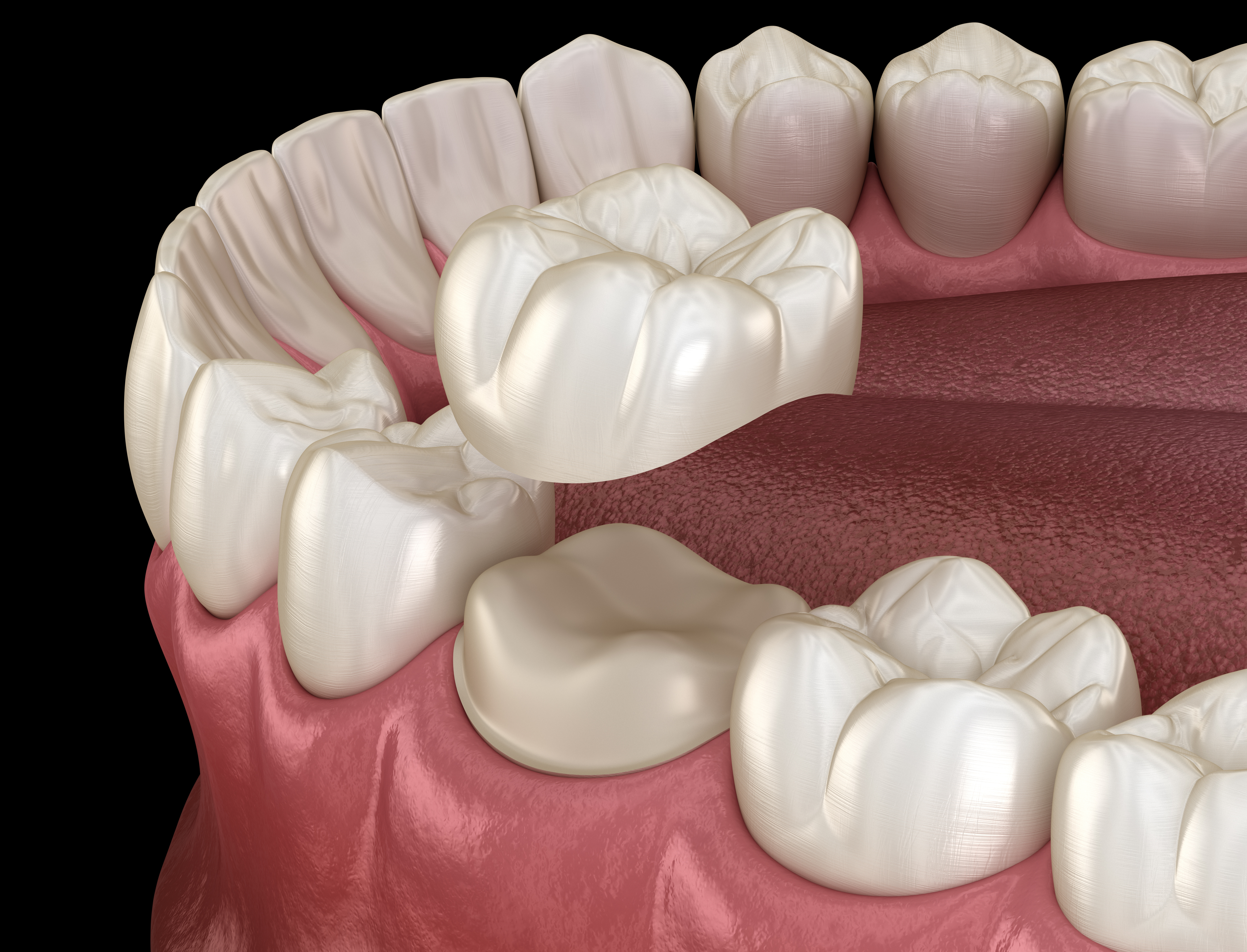 Restorative Dentistry