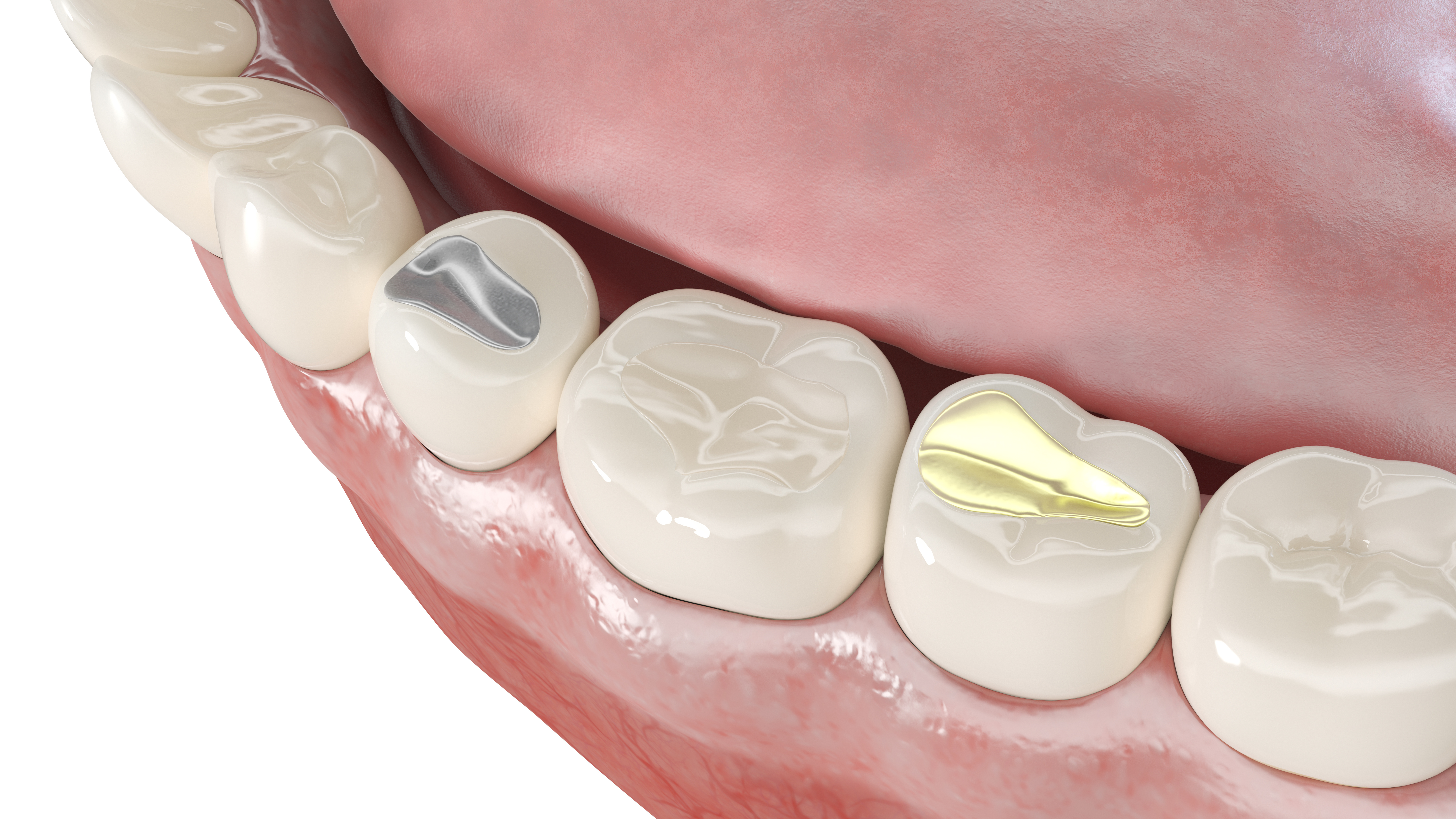 Healthy smile