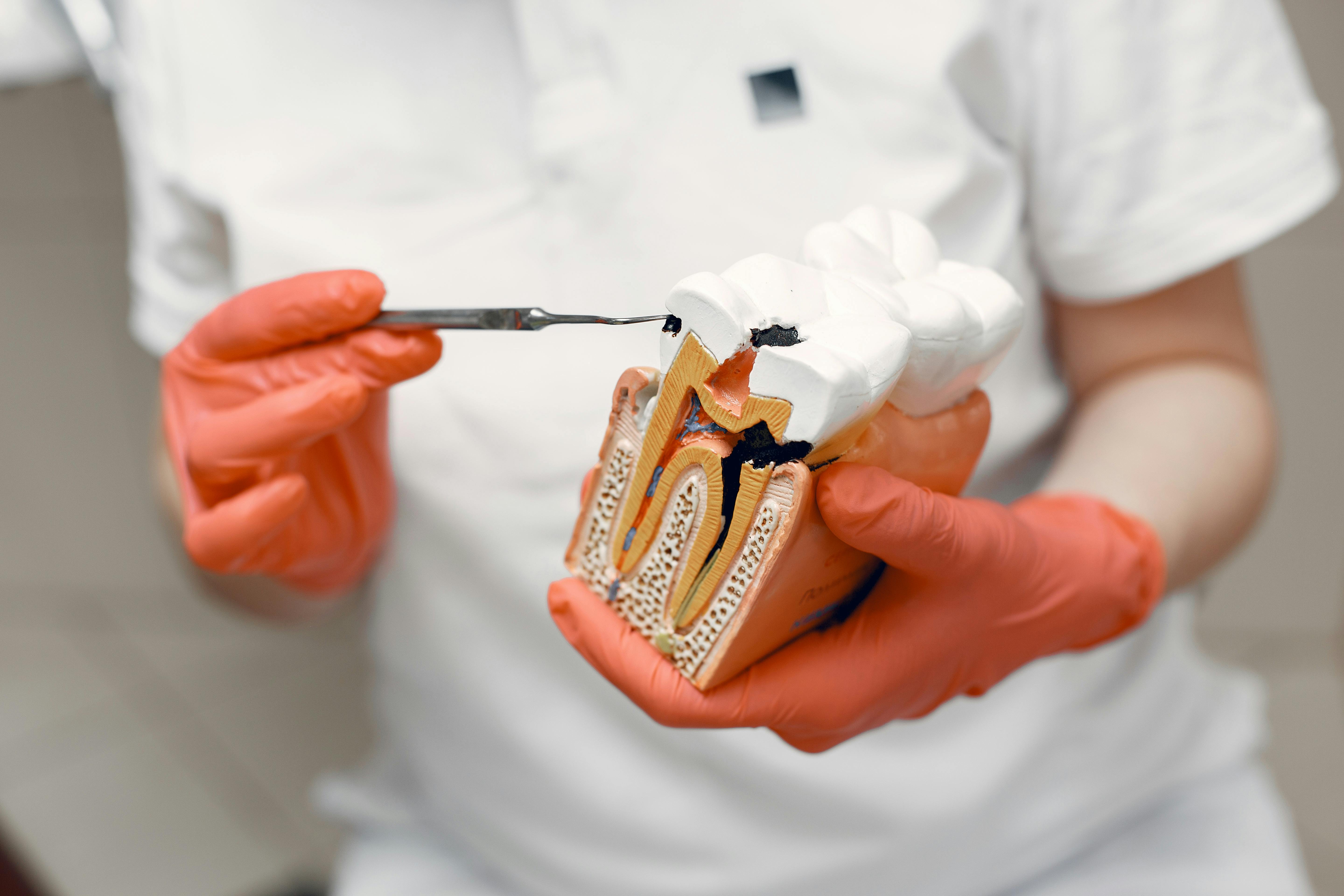 Root canal treatment