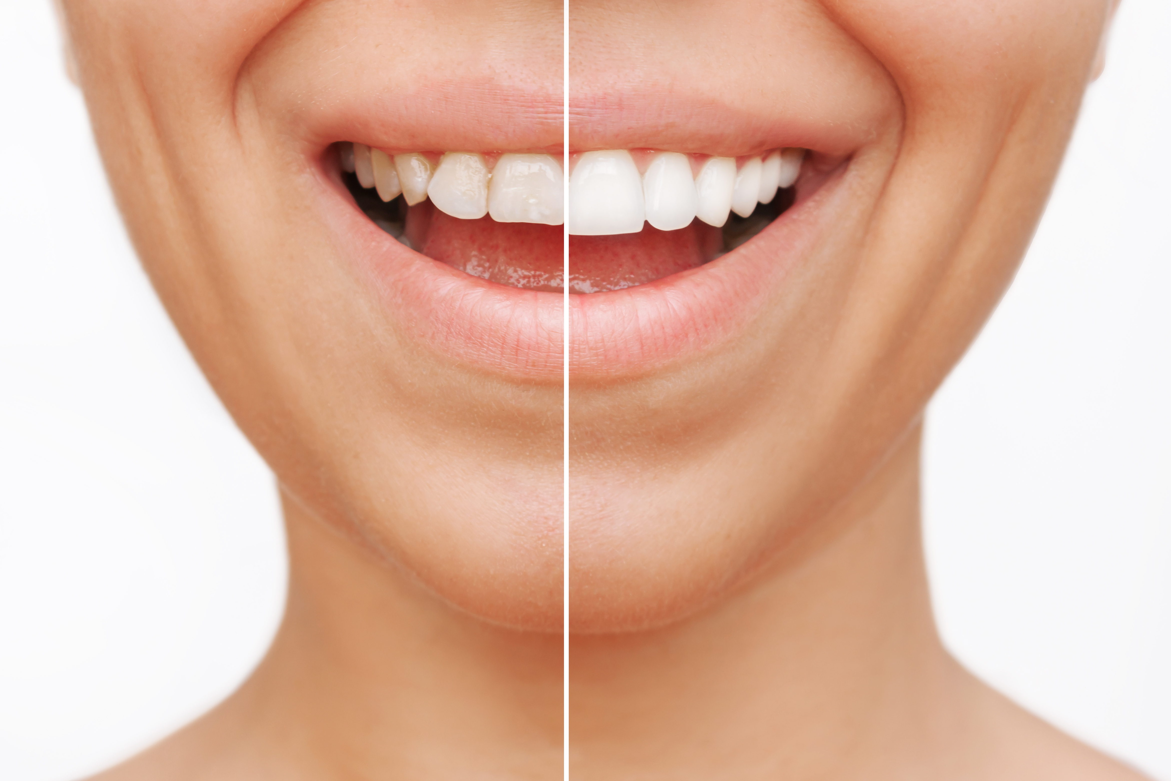Cosmetic Dentistry